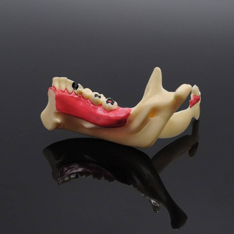 Dentistry Teaching Training Mandibular Model