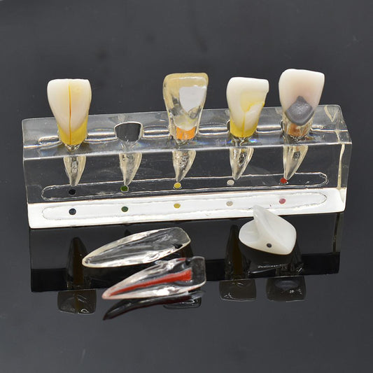 Dental endodontic pathological  endo model