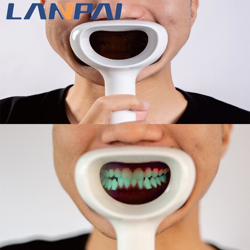 Dental Plaque Indicator Oral Digital Observer