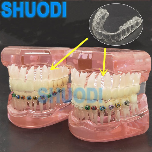 Dental Tooth Orthodontic Model with Invisible Transparent Bracket